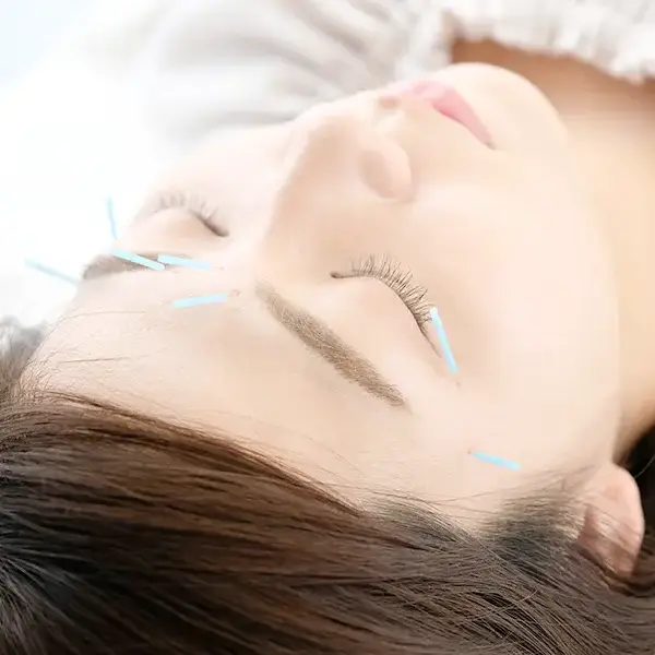 健康美容鍼灸