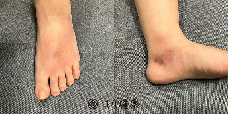初回施術前の状態
